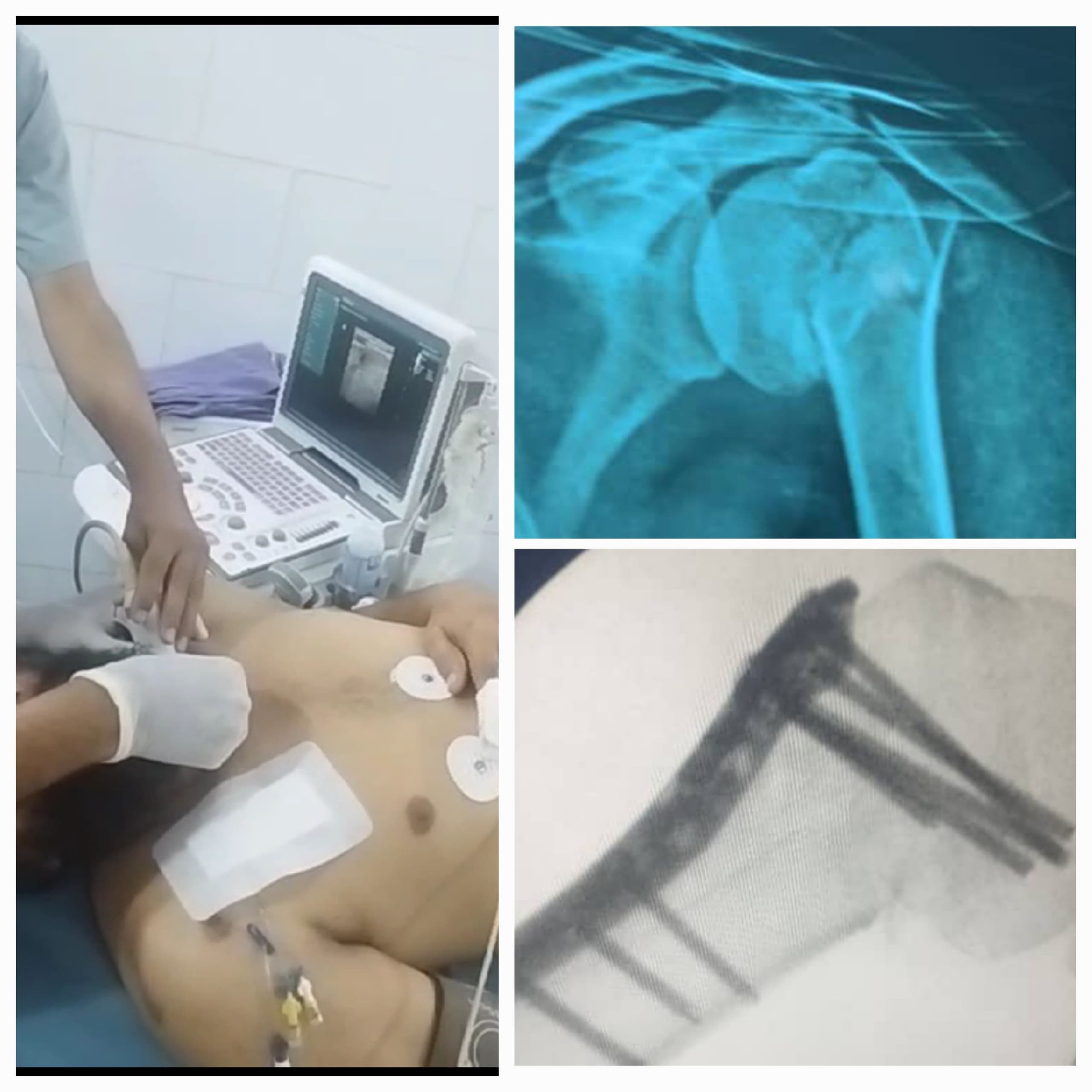 لأول مرة بعدن.. فريق طبي ينجح باجراء عملية نوعية جراحية باستخدام التخدير الطرفي