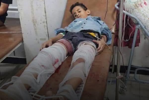 إصابة طفلين برصاص قناصة الحوثيين في تعز