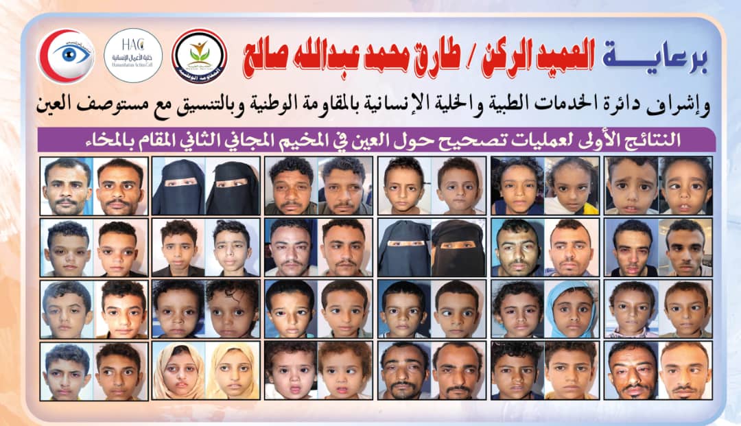 نجاحات مبهرة في أولى عمليات تصحيح الحَوَل بالمخاء ضمن المخيم المجاني الثاني برعاية طارق صالح