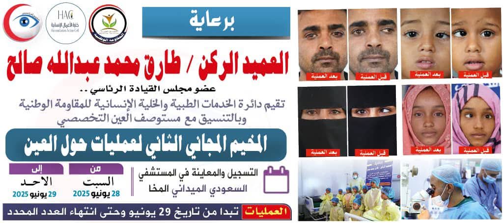 أكثر من 150 عملية مجانية ناجحة في مخيم طبي لجراحة حَوَل العين في المخا