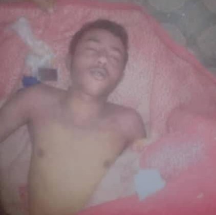 تحت التعذيب… وفاة سجين لدى الحوثيين بعمران